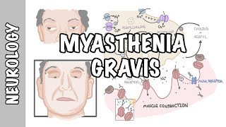 Myasthenia Gravis  symptoms pathophysiology investigations treatment [upl. by Nosreh301]