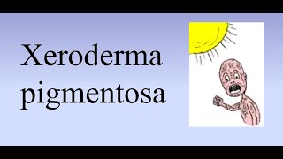 Xeroderma pigmentosum XP [upl. by Salomone]