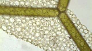 Hydrodictyon a netlike green alga [upl. by Lorrimor]