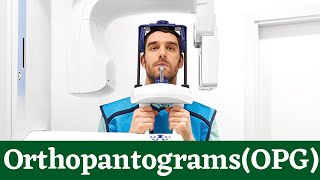 Orthopantomogram OPG XRay Machine Dental XRays Purpose amp Procedure What Are OPG Used For [upl. by Eniotna]