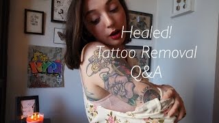 Tattoo Removal Healed qampa [upl. by Simson]