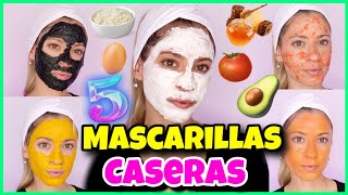 5 Mascarillas Caseras para tener la PIEL PERFECTA Y BONITA SIN ACNÉ Y SIN MARCAS  NatyGloss [upl. by Cusack]