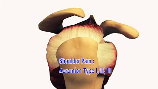 Acromion Types I II II  The Definitive Guide [upl. by Brandenburg]