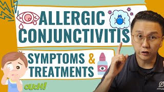 Pink eye  Allergic Conjunctivitis Symptoms and Treatments [upl. by Neelya]