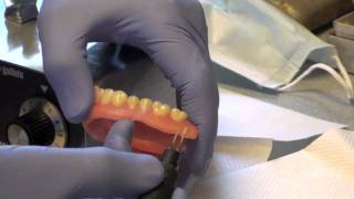 Denture Soft Reline Part 2 [upl. by Ramilahs389]