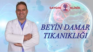 Beyin Damar Tıkanıklığı Tedavileri [upl. by Lauzon]