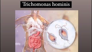 Trichomonas hominis [upl. by Gibbons]