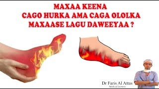 MAXAA KEENA CAGO HURKA AMA CAGA OLOLKA MAXAASE LAGU DAWEEYAA Dr faris [upl. by Lirba797]