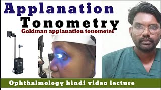 applanation tonometry  Goldman applanation tonometer  tonometer  applanation tonometer procedure [upl. by Woodward]