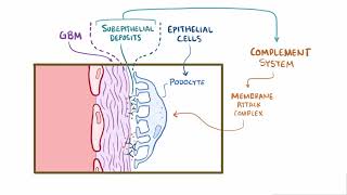 Membranous Glomerulonephritis  Renal Pathology  Osmosis [upl. by Zetroc808]