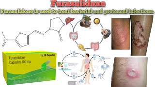 Furazolidone  INFORMATION  Furazolidone Uses  How Furazolidone works Common side effects [upl. by Isbella]