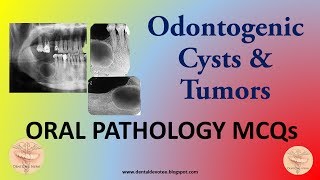 Oral Pathology MCQs  Cysts and Tumors of the Jaws and Oral Cavity [upl. by Isabelle578]