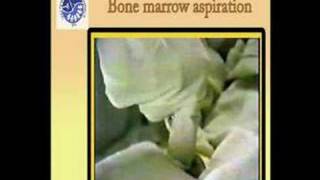 Pediatric Bone Marrow Aspiration [upl. by Ressler453]