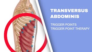 Abdominal Pain IBS and Trigger Points  An Overview [upl. by Oibaf]