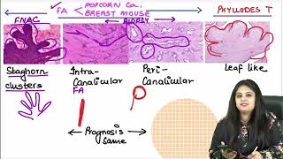 Pathology RR Part 1  DrPreeti Sharma  FMGE amp NEETPG [upl. by Atwekk]