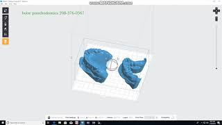 Preform Software loading dental model stls [upl. by Rabma]