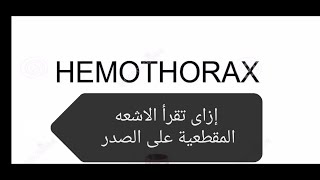 إزاى تقرأ الاشعه المقطعية على الصدر تدمي الصدر Hemothorax [upl. by Naneek]