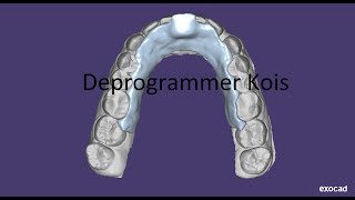 Deprogrammer Kois Exocad Tutorial  Депрограмматор Койса в экзокад [upl. by Monie]