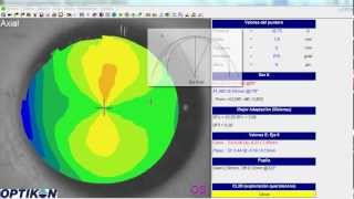 Curso Online Óptica y Optometría realizado por Formación Optométrica [upl. by Namron511]