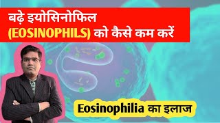 Eosinophilia का इलाज  Treatment of High Eosinophil in Blood [upl. by Bouton]