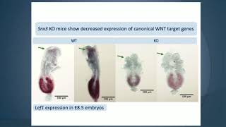 Phenotyping Embryonic Lethal Knockout mice with neural crest and neural defects  Lee Niswander [upl. by Sikram]