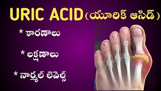 High URIC ACID causes  symptoms in Telugu  యూరీక్ యాసిడ్ [upl. by Brookhouse]