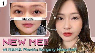 Why I Chose Korea for My REVISION SurgeryRevision Double Eyelid Thread Lifting Skin Booster LIPO [upl. by Echikson]