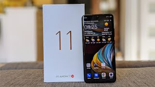 ZTE Axon 11 5G z małą pomocą OnePlus Nord [upl. by Rojam857]