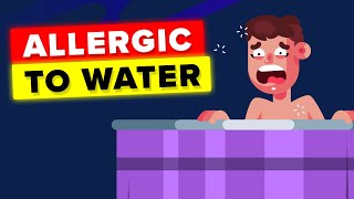 Woman Allergic to Water This is How She Lives [upl. by Margo120]