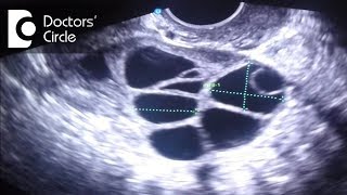 What do follicle size change in follicular study scan signify  Dr Teena S Thomas [upl. by Hamo102]