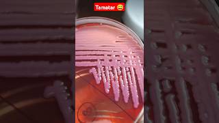 klebsiella bacteria 🦠🧫shorts youtubeshorts labtechnologist medicallabtechnician [upl. by Annissa]