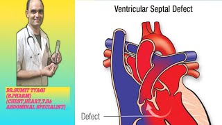 VENTRICULAR SEPTAL DEFECT BY DRSUMIT TYAGISUMITMEDICALDISPENSARY1 [upl. by Eedebez550]