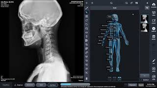 Digital Xray Software Demo [upl. by Roth]