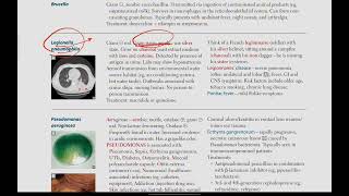 Klebsiella Legionella  Microbiology  20  First Aid USMLE in UrduHindi [upl. by Assiluy]