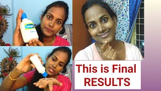 Cetaphil Gentle Skin Cleanser Review amp Demo in Telugu  Best Face wash for Dry amp Sensitive skin [upl. by Oirom782]