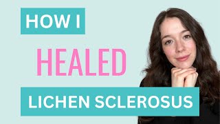 LICHEN SCLEROSUS How I Healed my Lichen Sclerosus [upl. by Norreht]