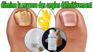 élimine la mycose des ongles définitivement  conseils [upl. by Ennaear776]