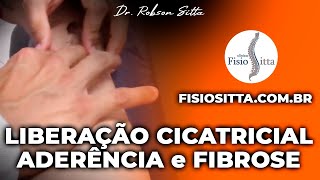 MASSAGEM de LIBERAÇÃO CICATRICIAL PREVENÇÃO ADERÊNCIA FIBROSE Clínica Fisioterapia Dr Robson Sitta [upl. by Aramanta]