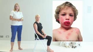 Top Tips for Anaphylaxis  First Aid [upl. by Zoubek]