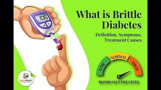 Fluctuating Blood Sugar Levels in Diabetes  Brittle Diabetes  Causes Complications and Treatment [upl. by Tedder]