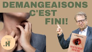 Comment en finir avec les démangeaisons Conseils dun dermatologue [upl. by Yesnikcm]