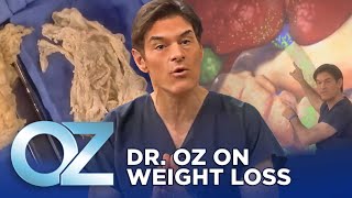 Dr Oz on Weight Loss  Oz Weight Loss [upl. by Lleumas]