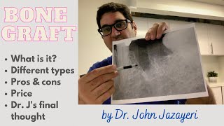 Bone Graft What is it Pros amp Cons  Different Types [upl. by Radec]