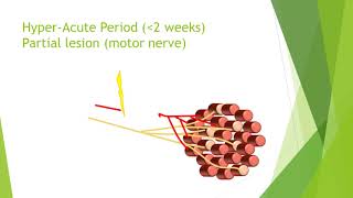 Nerve damage and repair [upl. by Dranoel]