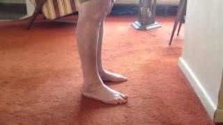 Knee genu recurvatum in standing and diminished Dorsiflexio [upl. by Anyrtak]