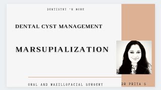 MARSUPIALIZATION MANAGEMENT OF ODONTOGENIC CYST PART 1Dr Priya [upl. by Conni]