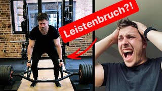 Erst LEISTENBRUCH dann KREUZHEBEN  Ich hab mich beim Training verletzt [upl. by Ontina]