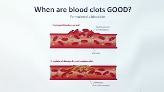 Anticoagulants [upl. by Harat]