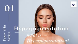 Video 1 Hyperpigmentation series for the esthetician What is hyperpigmentation [upl. by Akienahs]