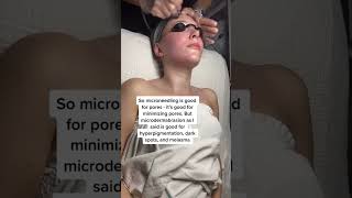 Benefits of Microdermabrasion [upl. by Wilow6]